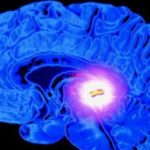 Des recettes miracles pour décalcifier sa glande pinéale…