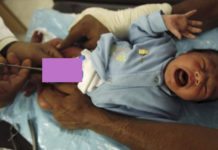 La circoncision provoque de lourdes conséquences psychologiques