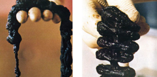 Parjure: 5 ans de prison, ou un nettoyage du côlon ?