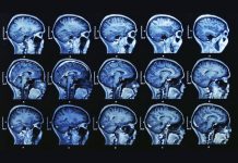 Lisez les conclusions choquantes de 28 études médicales établissant un lien entre le fluorure et la baisse du QI chez les enfants
