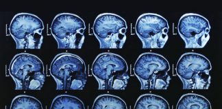 Lisez les conclusions choquantes de 28 études médicales établissant un lien entre le fluorure et la baisse du QI chez les enfants