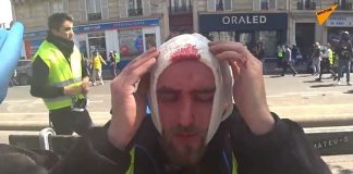 Les médecins révoltés par l’obligation de ficher les Gilets jaunes blessés