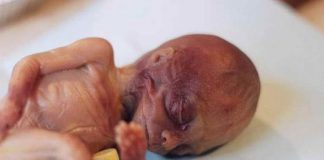 Cultures de foetus dans l’agroalimentaire : nous sommes tous cannibales, à l’insu de notre plein gré!