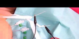 Cancer du sein: à toutes les femmes qui ne veulent pas être mutilées inutilement…