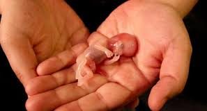 Vaccins de fœtus humains avortés