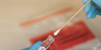 Les tests de dépistage du Corona ont été commandés en 2018 !