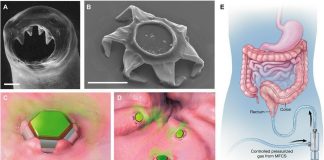 RÉCLAMATION : les écouvillons du test PCR peuvent contenir des “microdispositifs en forme d’étoile” qui vaccinent secrètement le “vaccin hésitant”